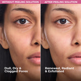 Moment Of Clarity AHA BHA PHA Peeling Solution
